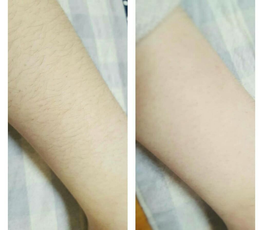 ブラックフォーム/Silky Remover/ボディサプリメントを使ったクチコミ(4枚目)