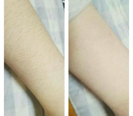 ブラックフォーム/Silky Remover/ボディサプリメントを使ったクチコミ(4枚目)