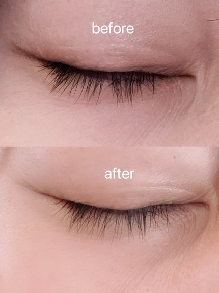 スカルプD ボーテ ピュアフリーアイラッシュセラム プレミアム/アンファー(スカルプD)/まつげ美容液を使ったクチコミ(2枚目)