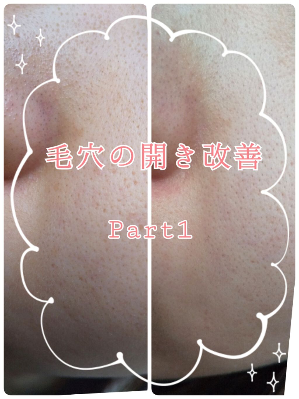 DHC マルチビタミン/DHC/美容サプリメントを使ったクチコミ（1枚目）