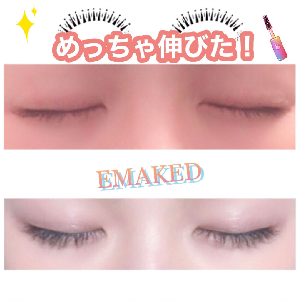 EMAKED使い始めてめっちゃ伸びました!!
使い始め(写真上)が12月、下が最近のまつげ🙌

はじめの1ヶ月は全く変化がなかったので、心配になりましたが2ヵ月目以降から太さと長さが出てきました!!

色素沈着が怖くて少しずつ使っていたの
