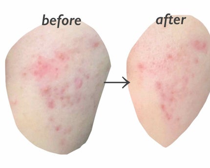 を使ったクチコミ(2枚目)