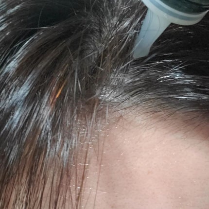 スカルプリッチ プロフェッショナル/日清食品/頭皮ローションを使ったクチコミ(5枚目)