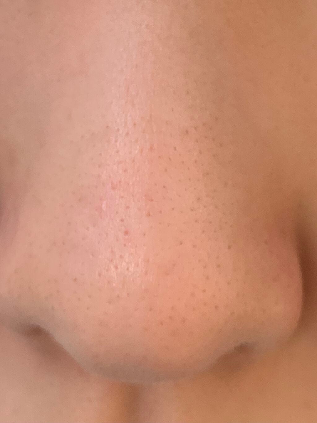 ハトムギ化粧水(ナチュリエ スキンコンディショナー R )/ナチュリエ/化粧水を使ったクチコミ(1枚目)