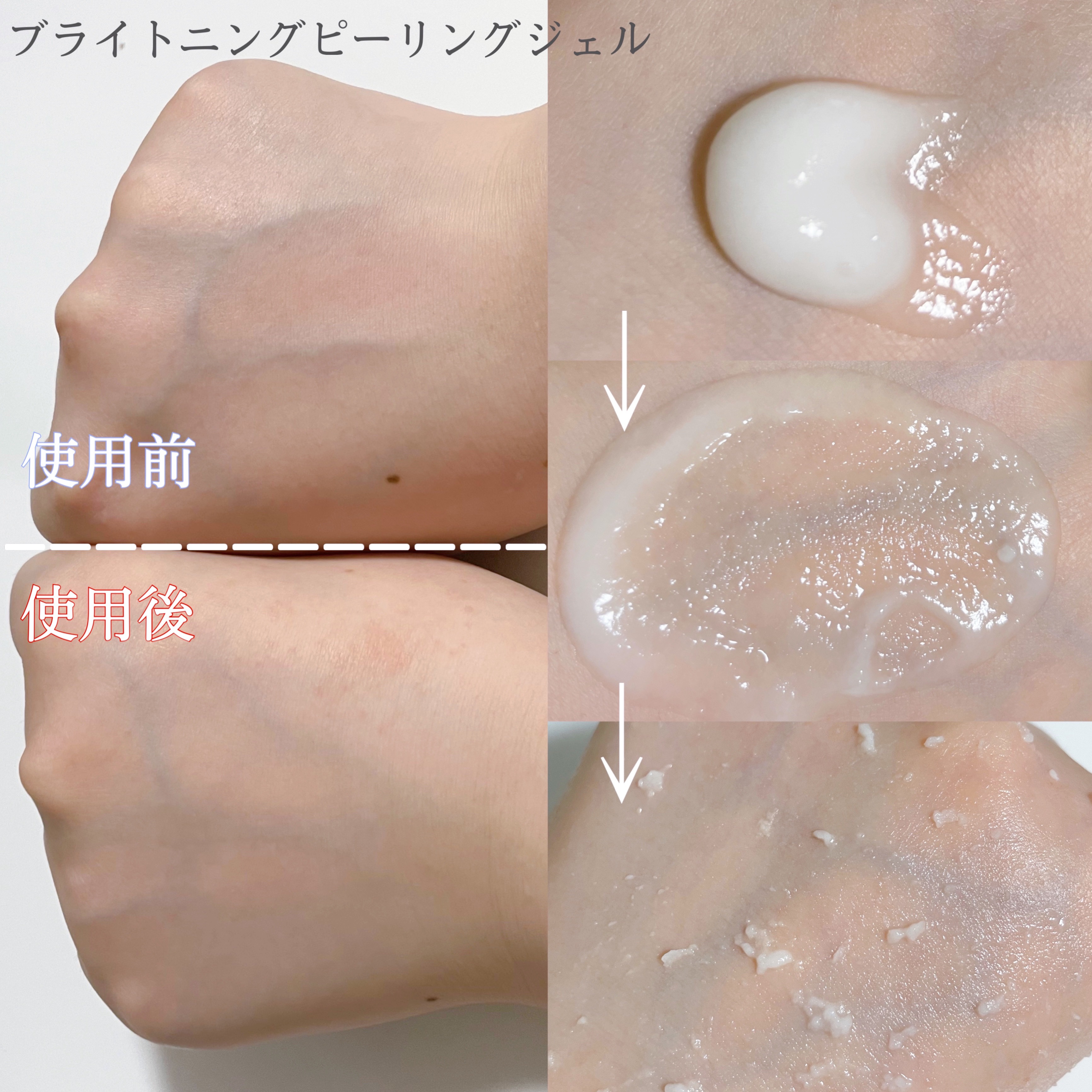 ブライトニングピーリングジェル/Dr.G/ピーリングを使ったクチコミ（3枚目）
