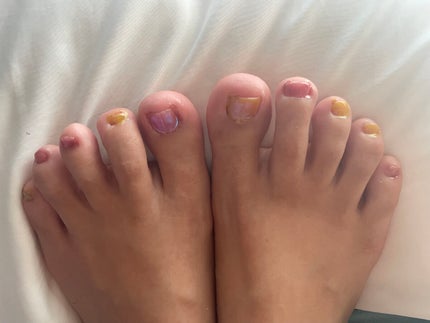 ネイルパーツ/セリア/ネイルチップ・パーツを使ったクチコミ(3枚目)