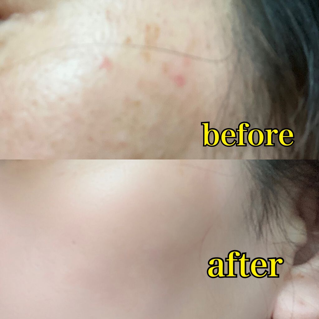 Wエッセンス/shimaboshi/美容液を使ったクチコミ(5枚目)