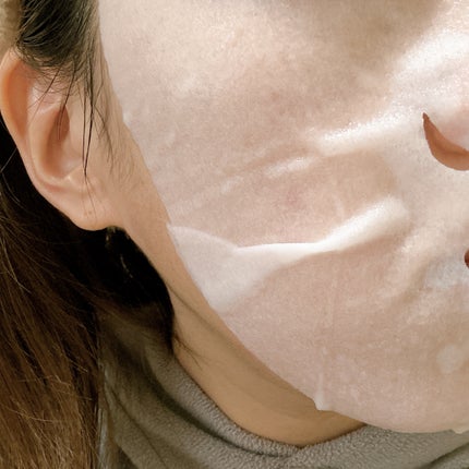 ルルルン ハイドラ V マスク/ルルルン/シートマスク・パックを使ったクチコミ(4枚目)