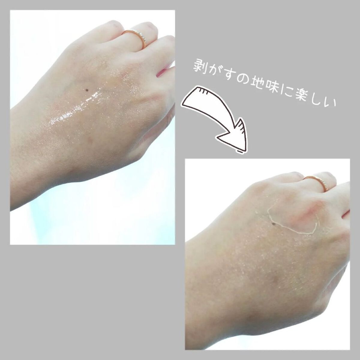 毛穴小町 イエローピールオフパック/クリアターン/ピーリングを使ったクチコミ（2枚目）