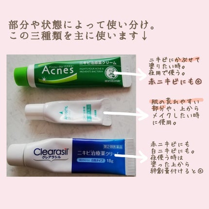 アポスティークリーム(医薬品)/アポスティー/その他を使ったクチコミ(2枚目)
