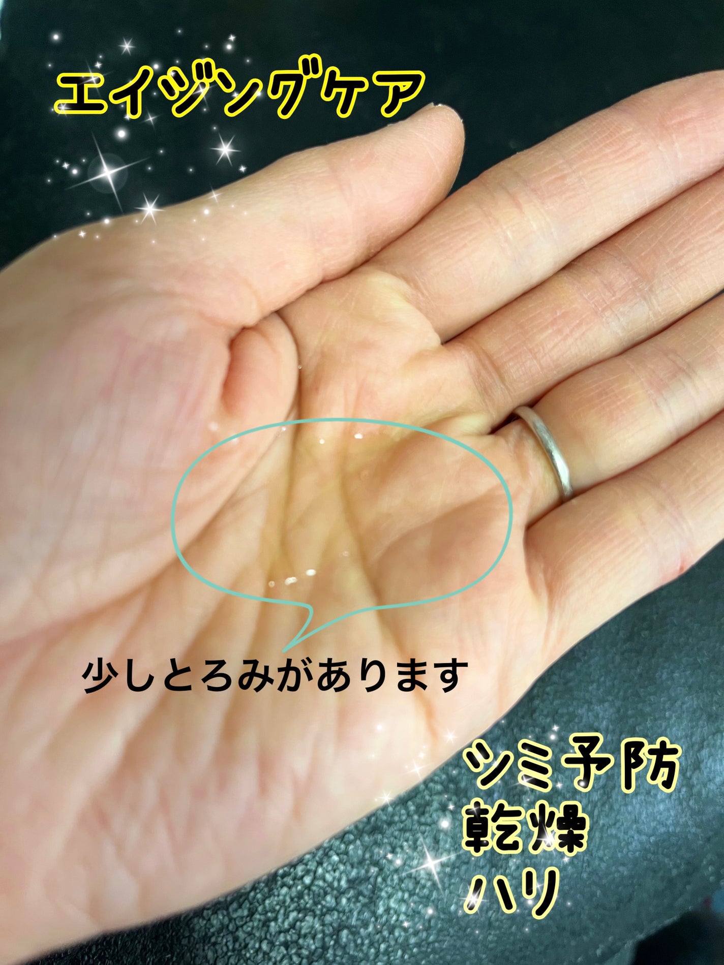 バウンシングケア ローション M/アクアレーベル/化粧水を使ったクチコミ(2枚目)