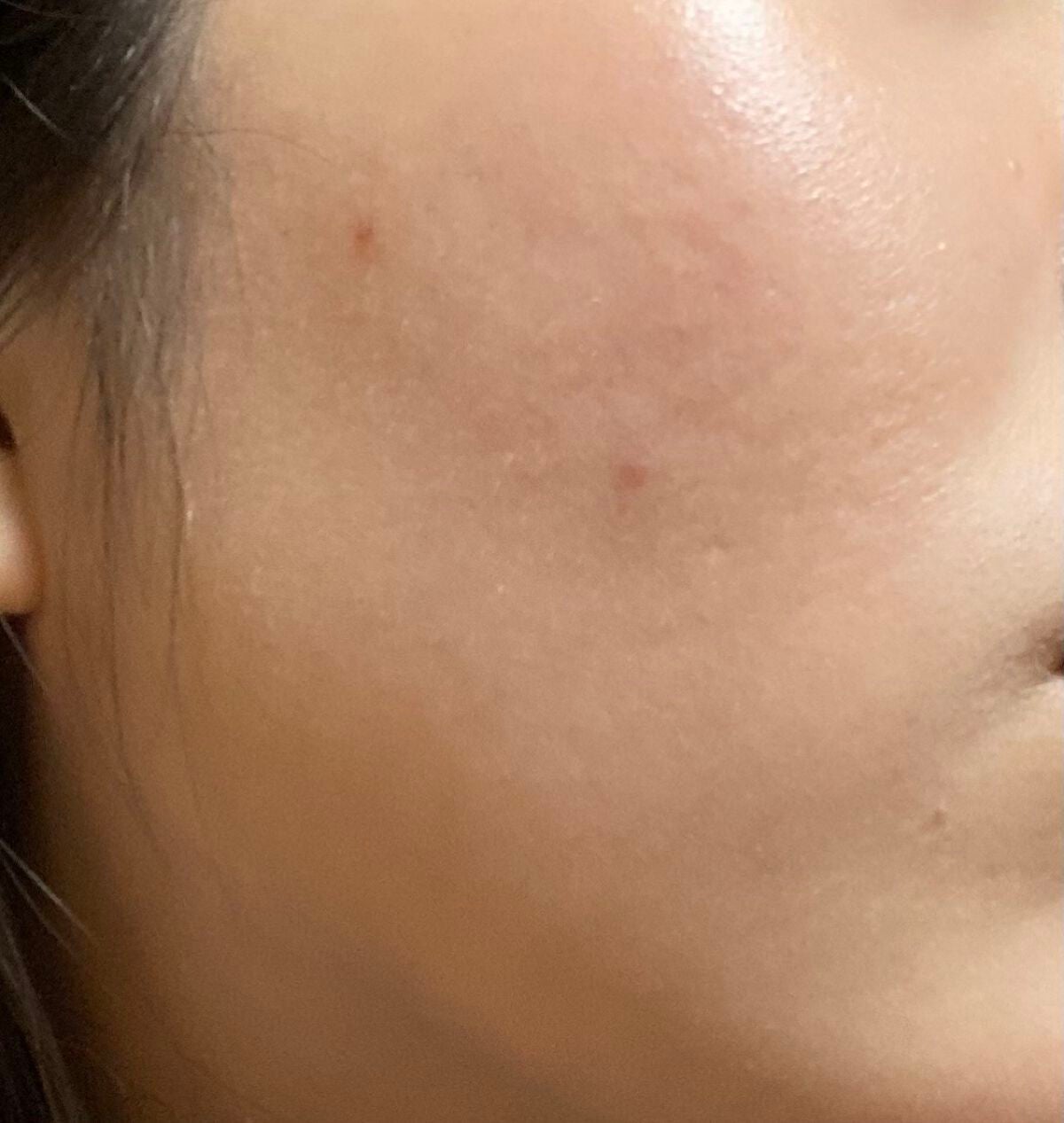 ロゼット洗顔パスタ アクネクリア/ロゼット/洗顔フォームを使ったクチコミ(5枚目)