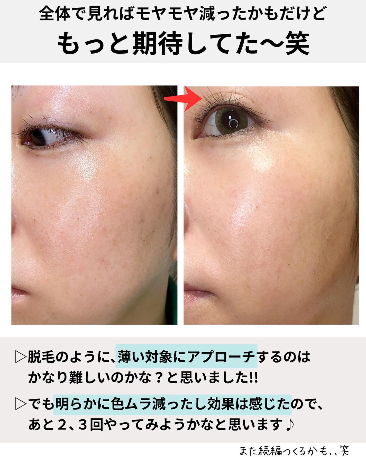 めがねちゃん👓フォロバ on LIPS 「←こちらから過去のおすすめが見られます✨元化粧品研究者のめがね..」(9枚目)