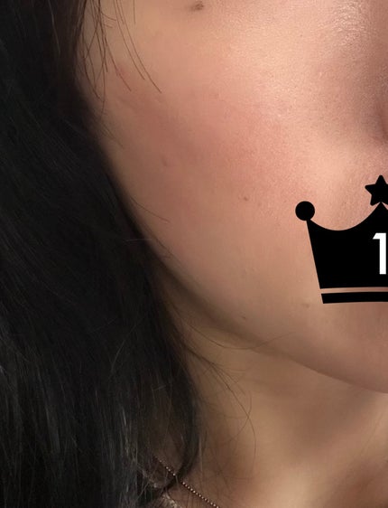 トゥルーディメンショングロウチーク/hince/パウダーチークを使ったクチコミ(1枚目)