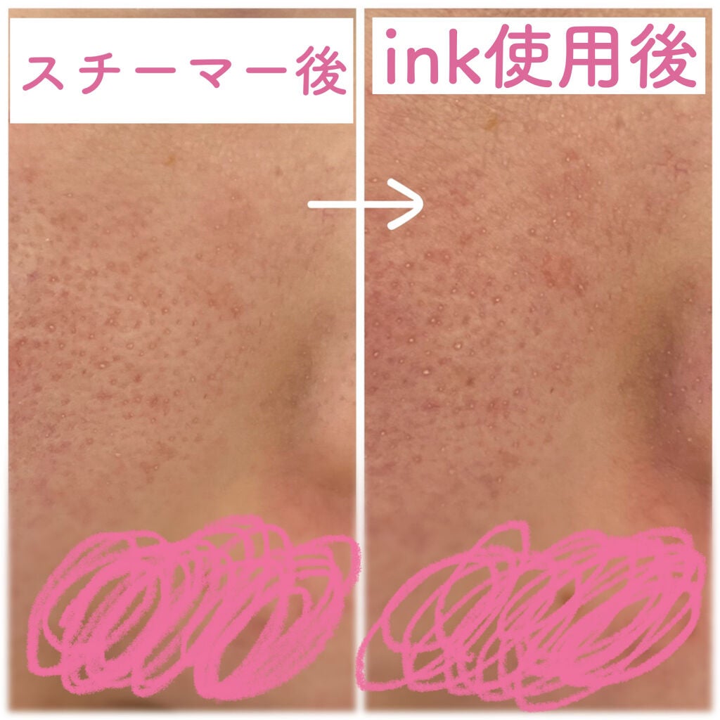 クレンジングバーム/ink./クレンジングバームを使ったクチコミ(3枚目)