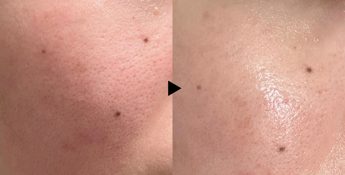 3番 集中ケアレチノール美容液/numbuzin/美容液を使ったクチコミ(5枚目)