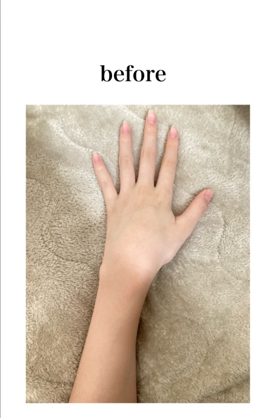 モイスチュアマイルド ホワイトローションL （さっぱり）/コーセーコスメポート/化粧水を使ったクチコミ（2枚目）