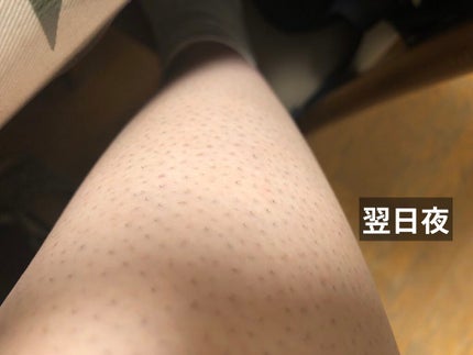 エピリムーバー/TBC/除毛クリームを使ったクチコミ(5枚目)