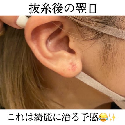 みや on LIPS 「こんばんは〜!!遅くなりましたが、あけましておめでとうございま..」(5枚目)