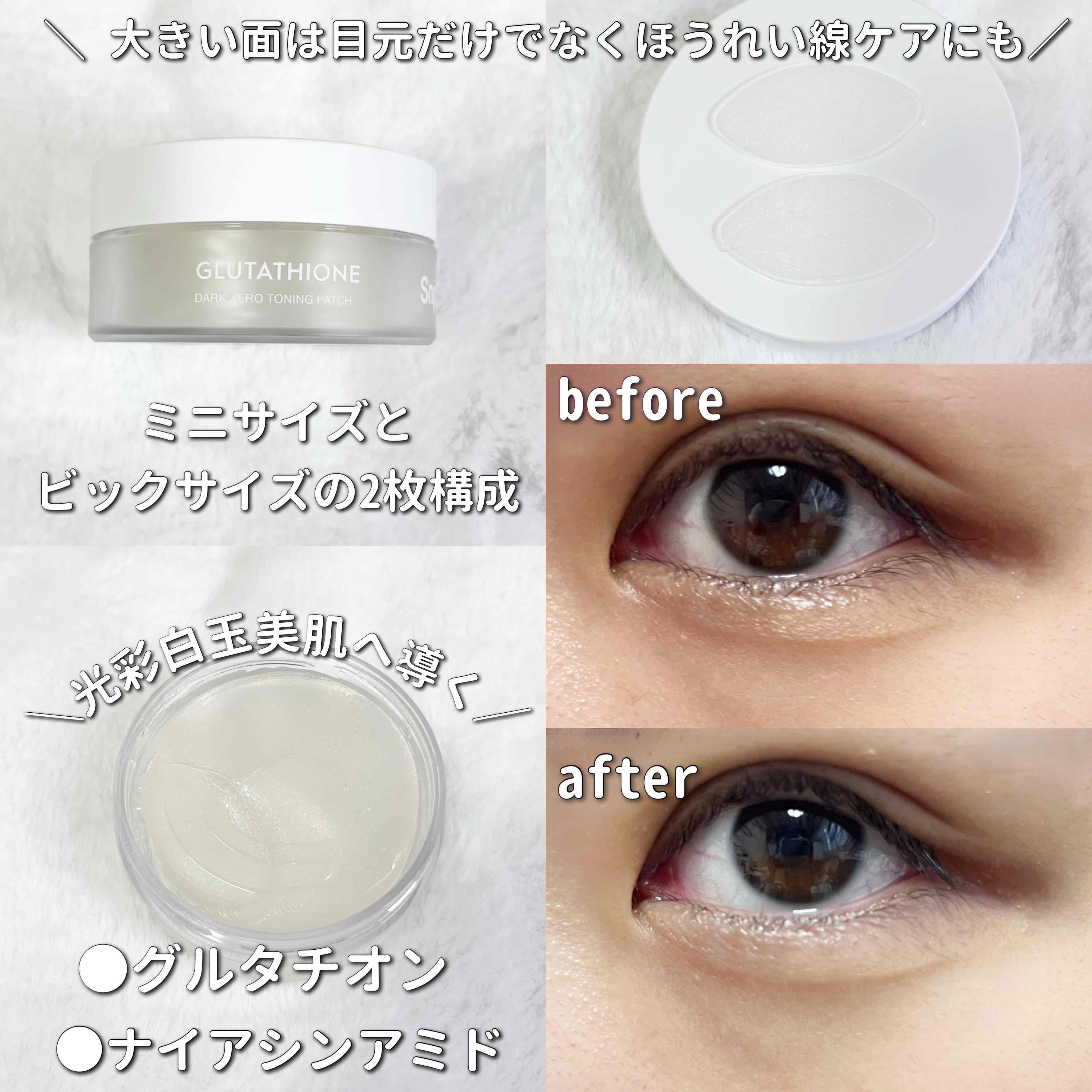 グルタチオンダークゼロトーニングパッチ/SNP/アイケア・アイクリームを使ったクチコミ（2枚目）