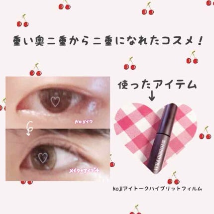 ハイブリッドフィルム/アイトーク/二重まぶた用アイテムを使ったクチコミ(1枚目)