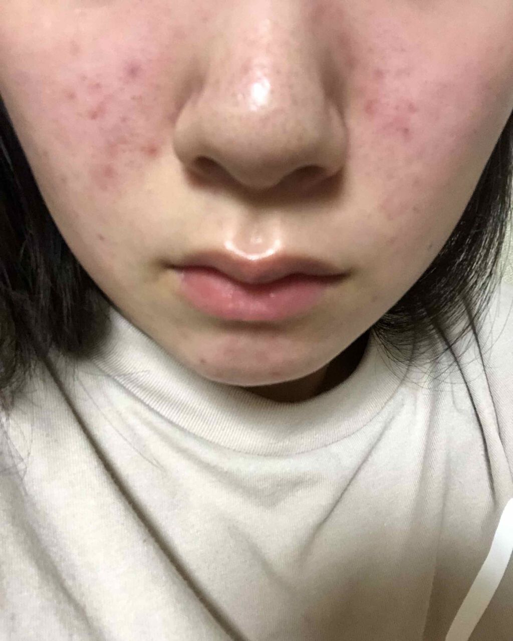 ハトムギ保湿ジェル(ナチュリエ スキンコンディショニングジェル)/ナチュリエ/美容液を使ったクチコミ（2枚目）