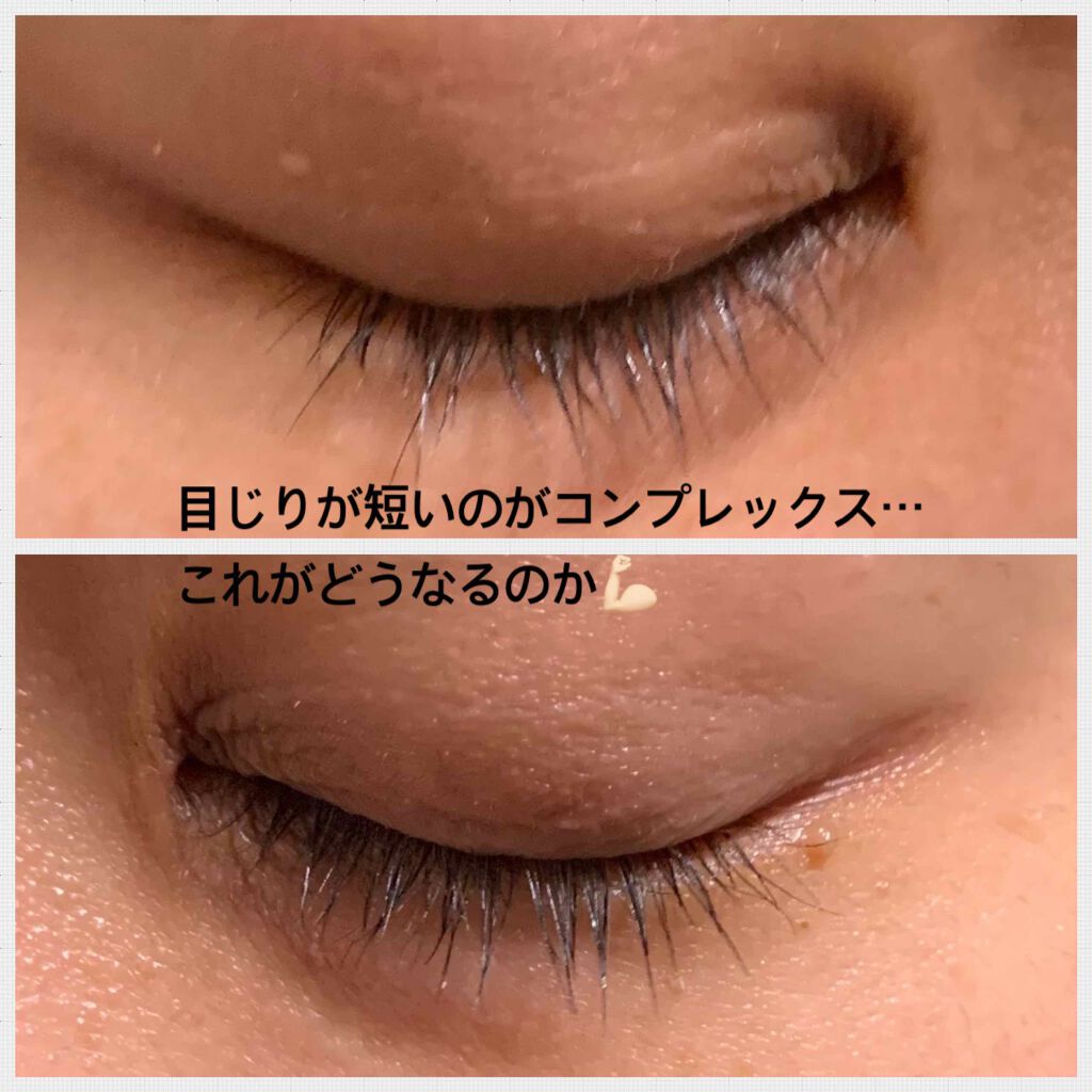 アイズワイズクリエイター/グランフィクサー/まつげ美容液を使ったクチコミ(3枚目)