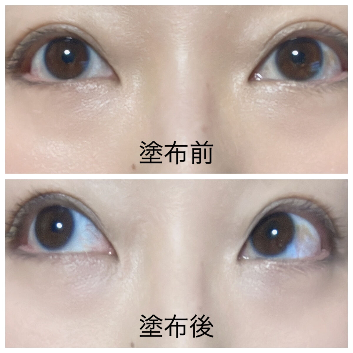 リシェ レッドトリック アイコンシーラー/Visée/パレットコンシーラーを使ったクチコミ（2枚目）