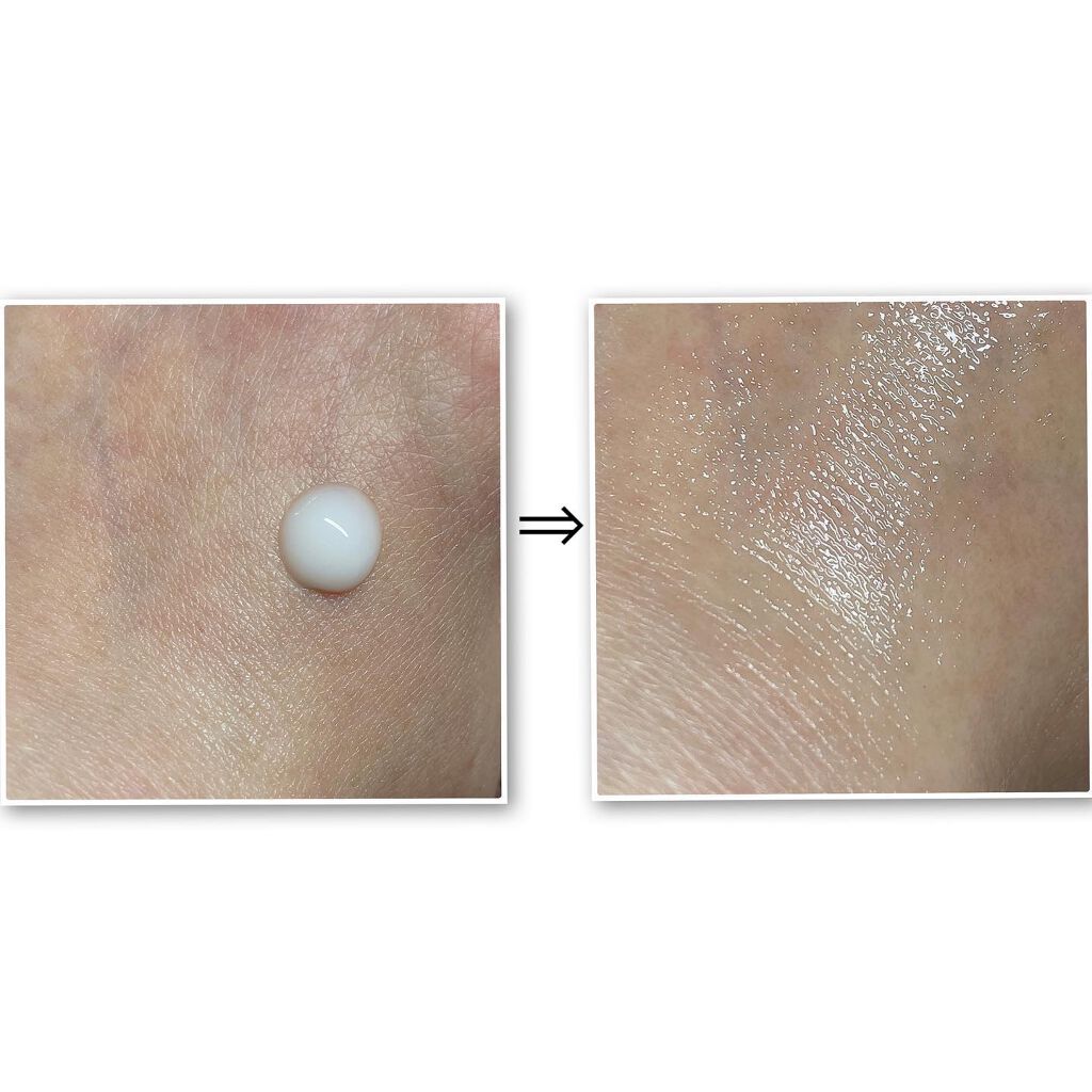 リアルカロテンブレミッシュクリアセラム/APRILSKIN/美容液を使ったクチコミ(5枚目)