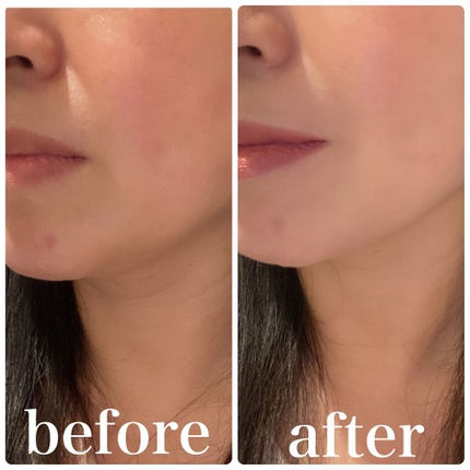 モイストラボ BBエッセンスクリーム/Moist Labo/BBクリームを使ったクチコミ(5枚目)