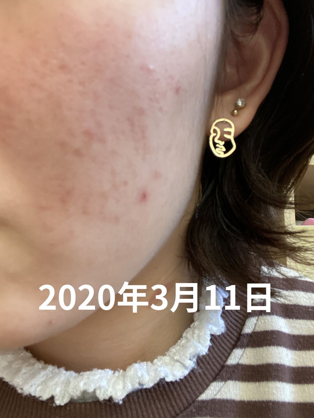 明色美顔水 薬用化粧水/美顔/化粧水を使ったクチコミ（2枚目）