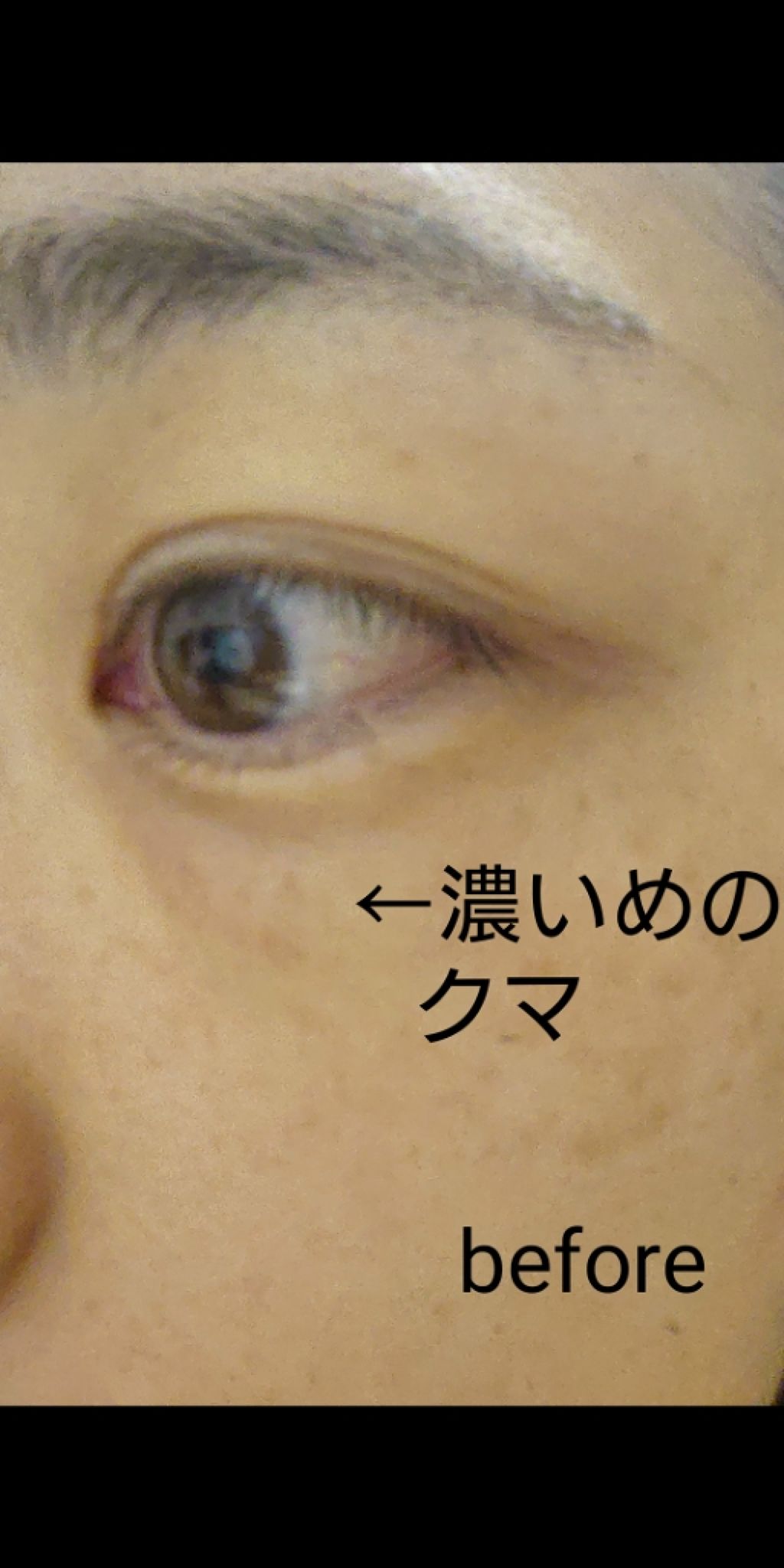 ザ コンシーラー/MISSHA/リキッドコンシーラーを使ったクチコミ（3枚目）