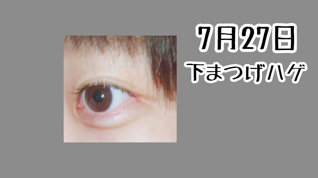 ローヤルゼリー配合 栄養ローション/DAISO/美容液を使ったクチコミ（2枚目）