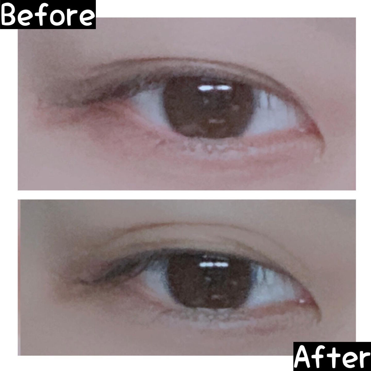 マイクロファイバー /ビー・エヌ/二重まぶた用アイテムを使ったクチコミ（3枚目）