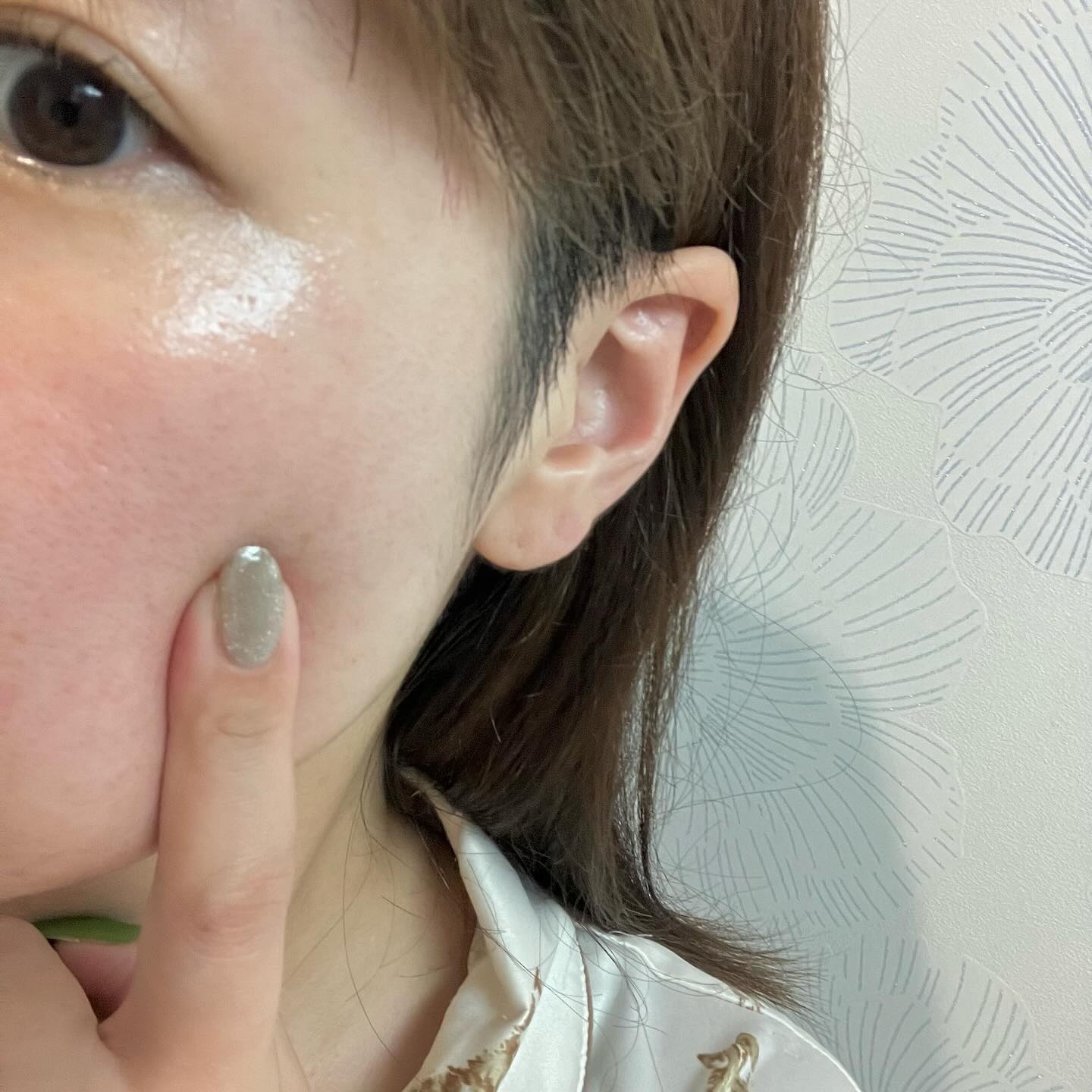 Cエッセンス VC5+PLUS /EBiS化粧品/美容液を使ったクチコミ（3枚目）