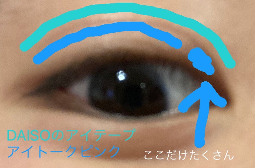 のびーるアイテープ(絆創膏タイプ、レギュラー)/DAISO/二重まぶた用アイテムを使ったクチコミ(2枚目)