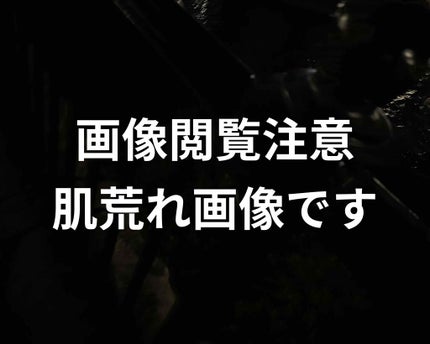 白潤 薬用美白化粧水(しっとりタイプ)/肌ラボ/化粧水を使ったクチコミ(1枚目)