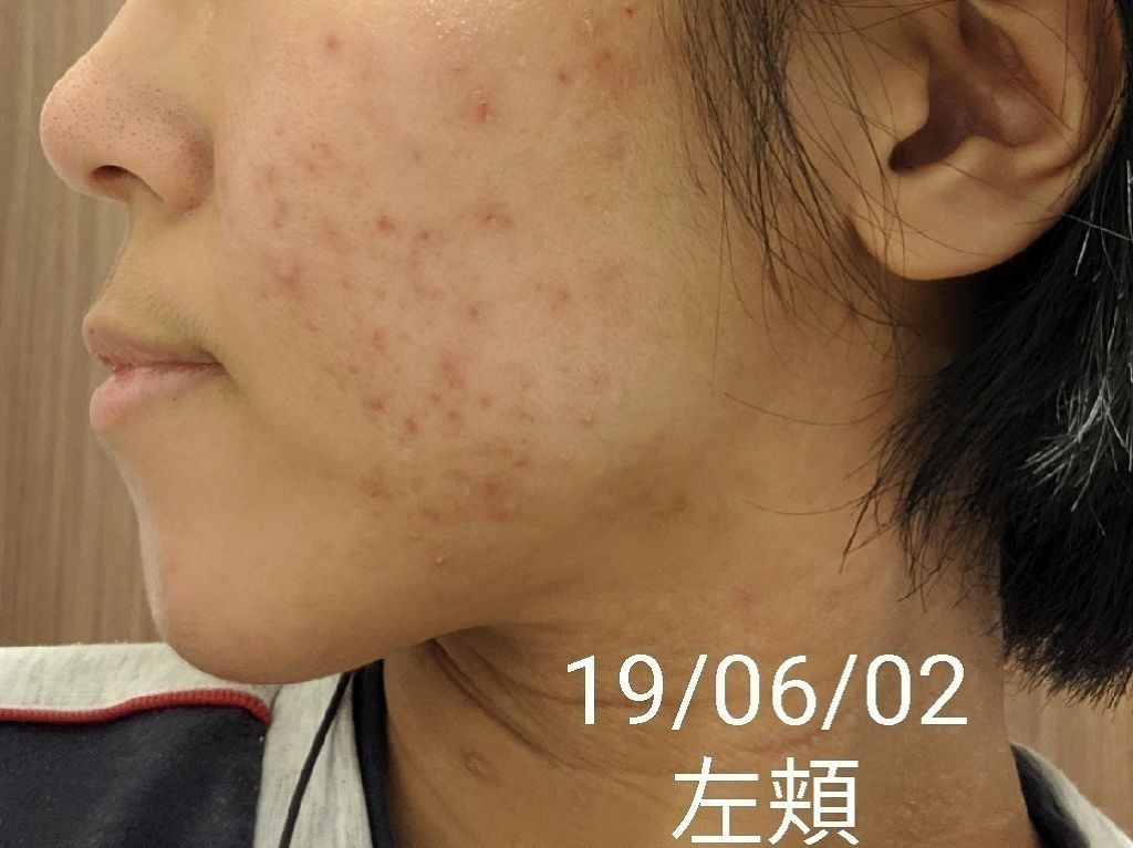 お肌断食水ローション/オリエン/ミスト状化粧水を使ったクチコミ(3枚目)