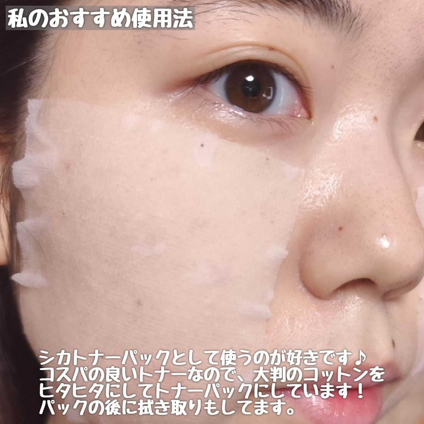 ティーツリーシカスージングトナー/BRING GREEN/化粧水を使ったクチコミ(6枚目)