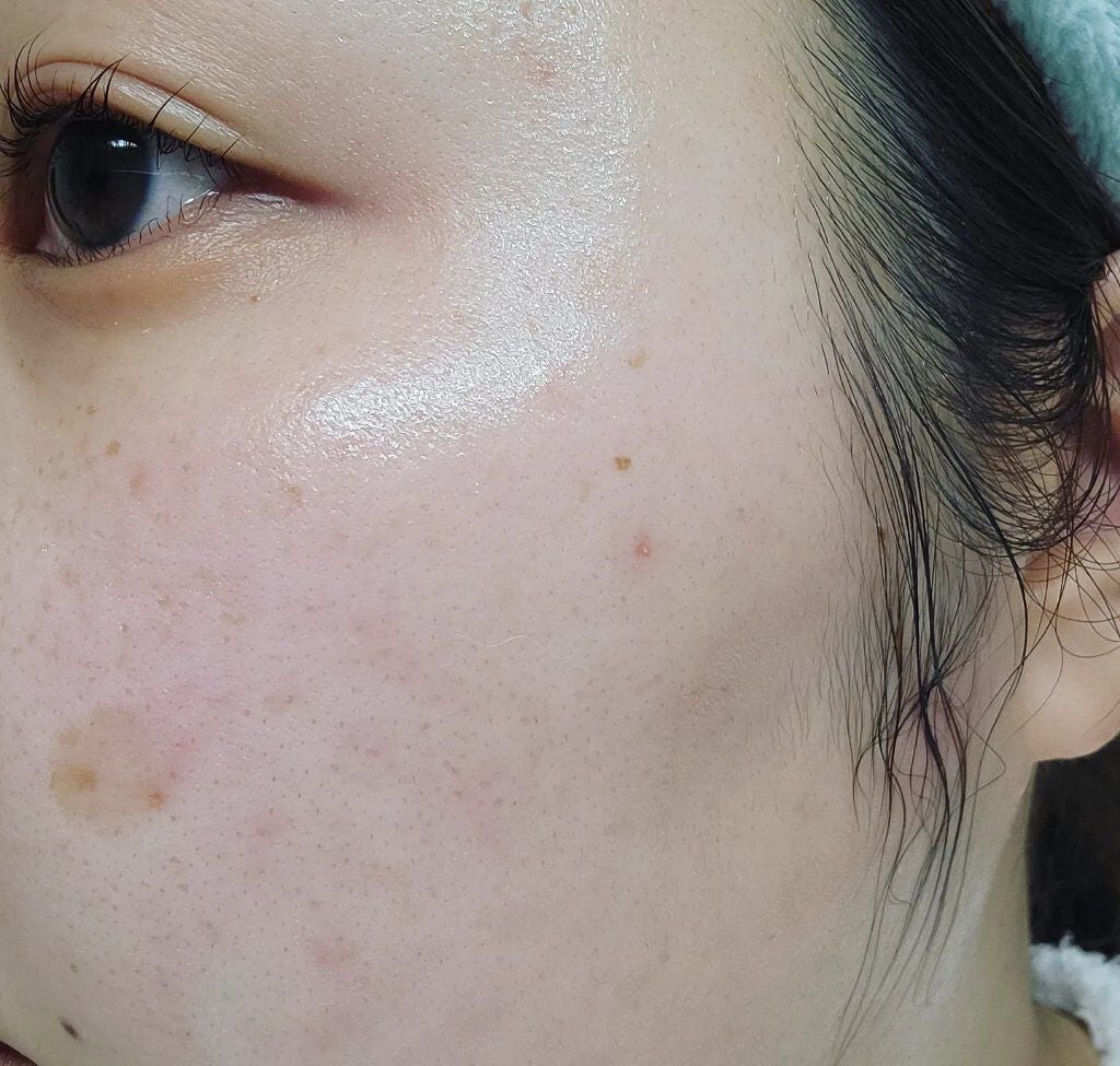 イプサ ME 6/IPSA/化粧水を使ったクチコミ(5枚目)