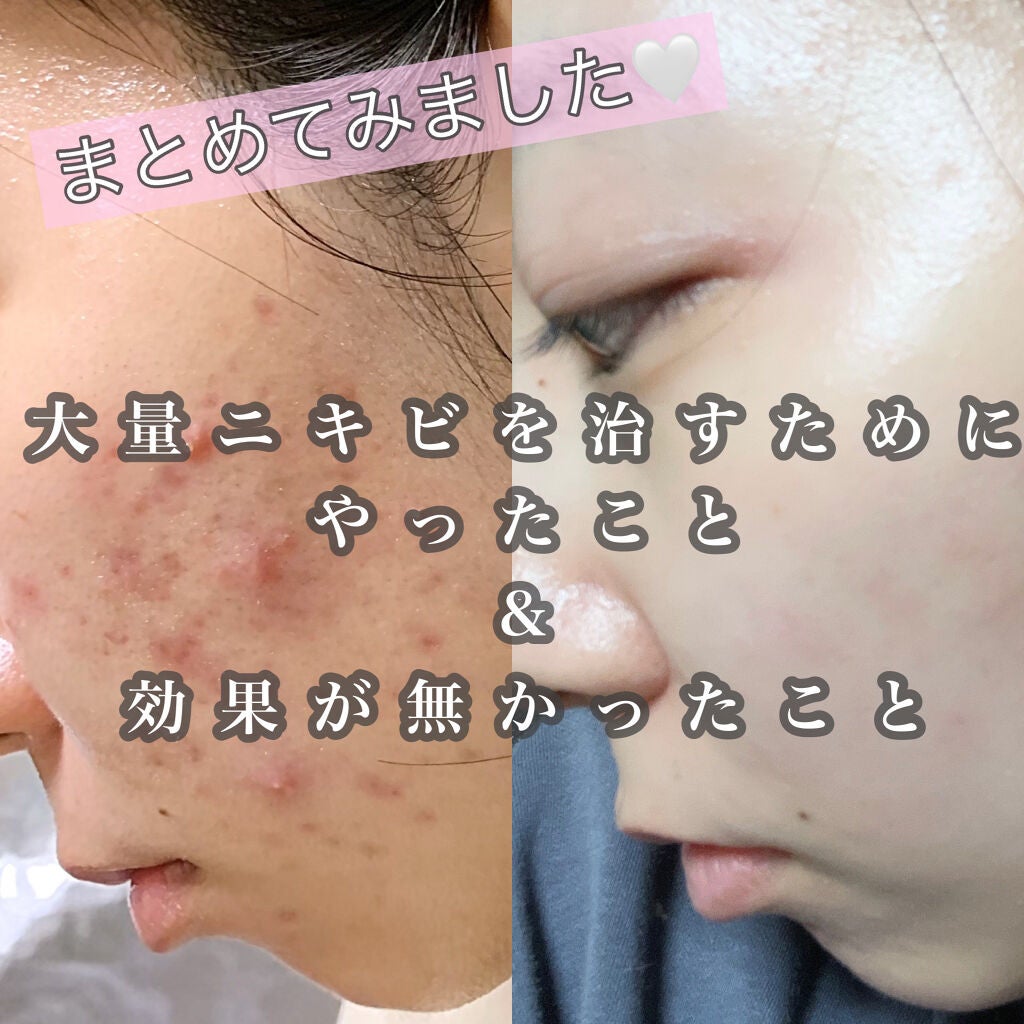 キレートレモン/Pokka Sapporo (ポッカサッポロ)/美容ドリンクを使ったクチコミ(1枚目)