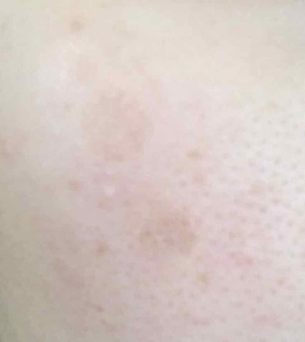 リップコンシーラー モイスト イン/キャンメイク/スティックコンシーラーを使ったクチコミ(4枚目)