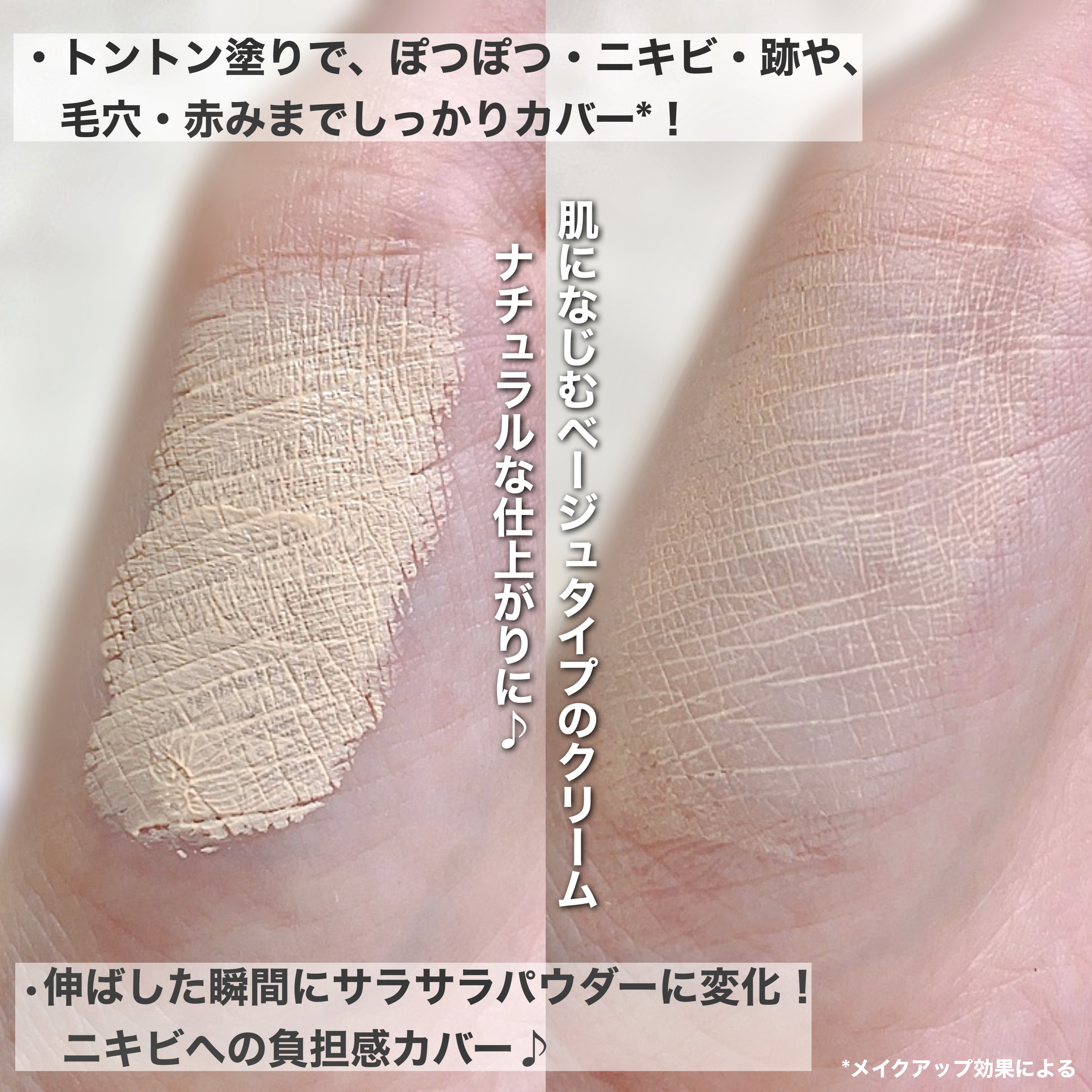 イプノス シーバムクリア リペアクリーム/ACSEINE/フェイスクリームを使ったクチコミ（3枚目）