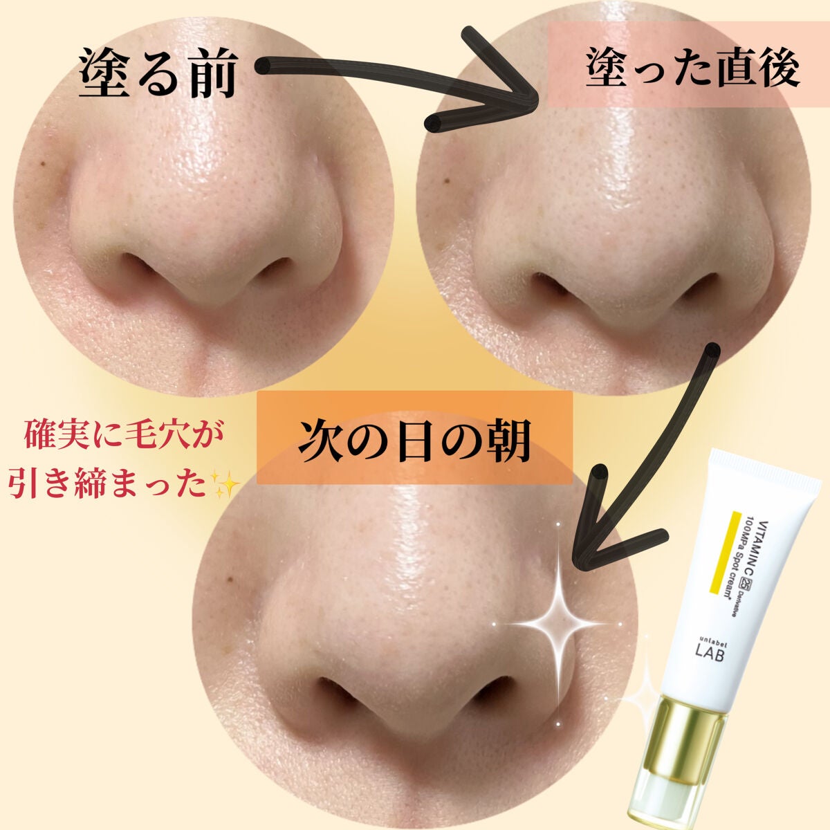 V スポットクリーム /unlabel/フェイスクリームを使ったクチコミ(2枚目)