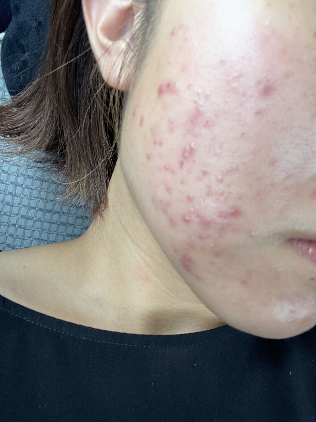 DHC マルチビタミン/DHC/美容サプリメントを使ったクチコミ（2枚目）