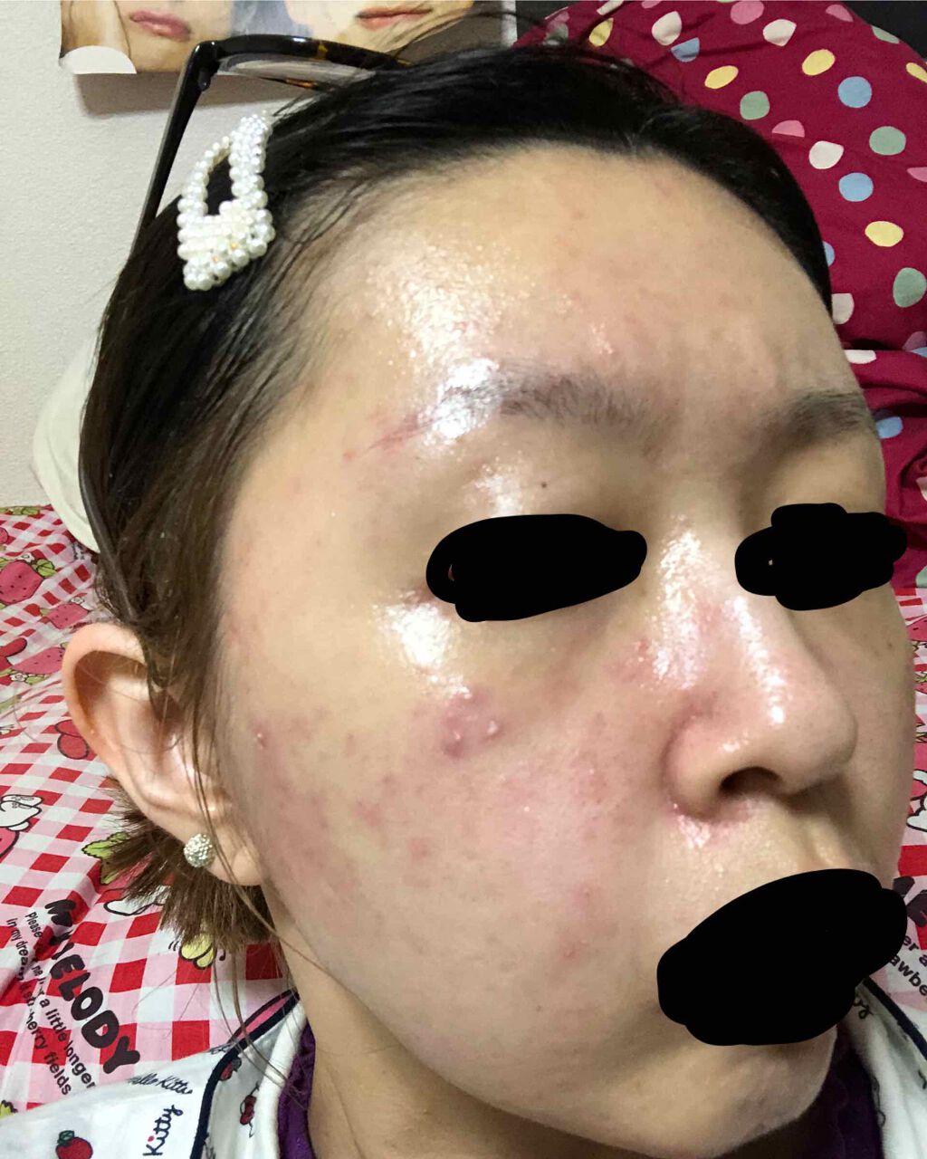 Sparksound on LIPS 「肌荒れメモなかなか治らないから皮膚科に行ったとくに薬は無く朝洗..」(2枚目)