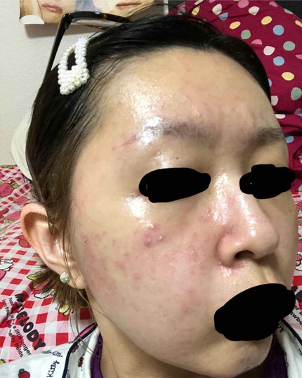 を使ったクチコミ(2枚目)