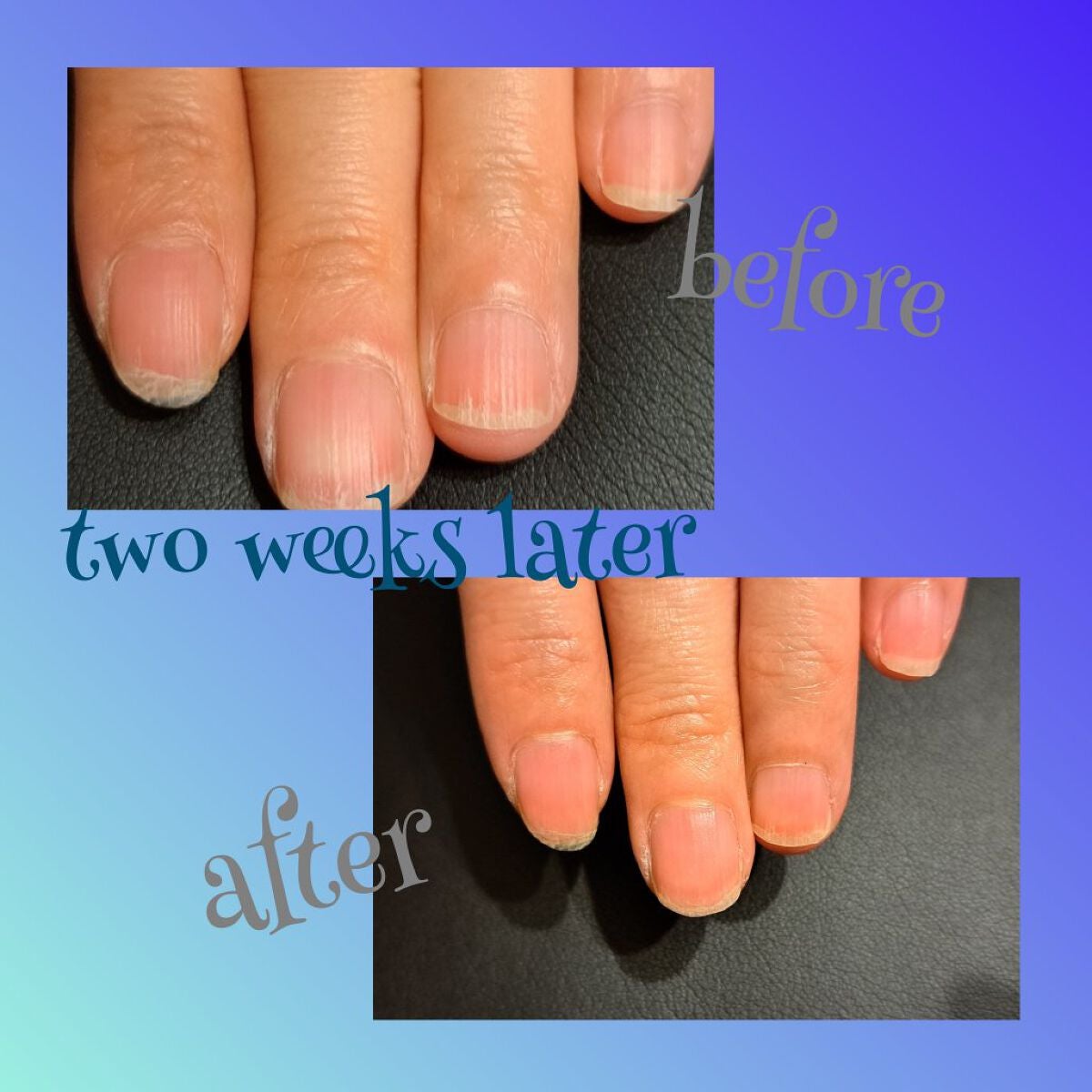 ディープセラム/Dr.Nail/ネイルオイル・トリートメントを使ったクチコミ(1枚目)