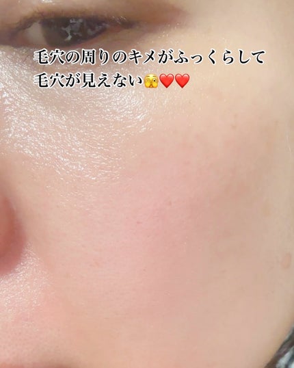 PDRNショット675/COSNORI/美容液を使ったクチコミ(4枚目)