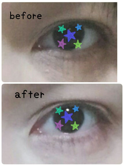 ワンダーアイリッドテープ 片面タイプ/D-UP/二重まぶた用アイテムを使ったクチコミ(7枚目)